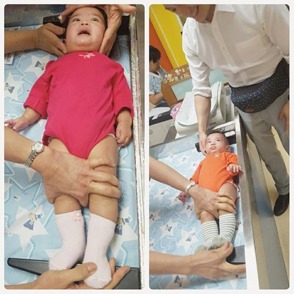 โอปอล์ มั่นใจมือหมอ ไม่หวั่น น้องอลิน ผ่าตัดรักษาลิ้นหัวใจตีบ โอปอล์ มั่นใจมือหมอ ไม่หวั่น น้องอลิน ผ่าตัดรักษาลิ้นหัวใจตีบ