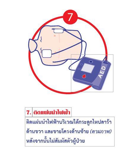 ช่วยชีวิตคนป่วยหัวใจหยุดเต้น ช่วยชีวิตคนป่วยหัวใจหยุดเต้น