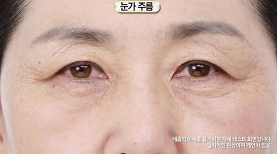 อย. สั่งเบรกแท่งสติ๊กลบตีนกา ลบริ้วรอยใน 1 นาที ชี้โฆษณาเกินจริง อย. สั่งเบรกแท่งสติ๊กลบตีนกา ลบริ้วรอยใน 1 นาที ชี้โฆษณาเกินจริง