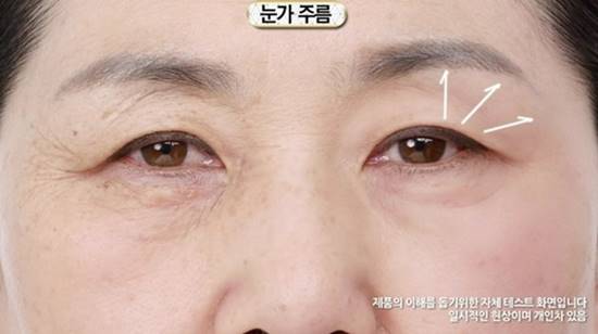 อย. สั่งเบรกแท่งสติ๊กลบตีนกา ลบริ้วรอยใน 1 นาที ชี้โฆษณาเกินจริง อย. สั่งเบรกแท่งสติ๊กลบตีนกา ลบริ้วรอยใน 1 นาที ชี้โฆษณาเกินจริง