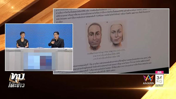 เตือนคนนอนน้อย ! อาจารย์แชร์ประสบการณ์ตรง เป็นโรคหน้าเบี้ยวครึ่งซีก เตือนคนนอนน้อย ! อาจารย์แชร์ประสบการณ์ตรง เป็นโรคหน้าเบี้ยวครึ่งซีก