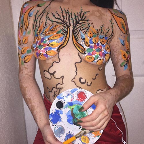 โรคด่างขาว โรคด่างขาว