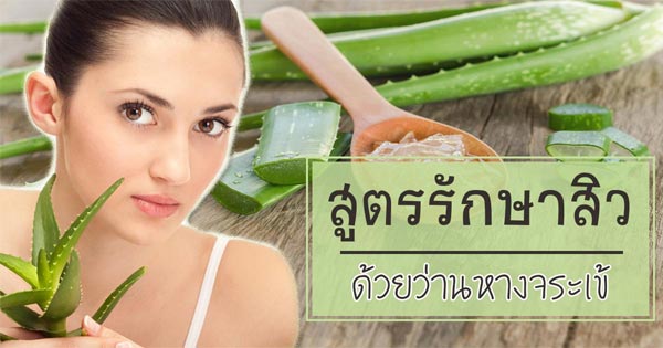 ว่านหางจระเข้ รักษาสิว ว่านหางจระเข้ รักษาสิว