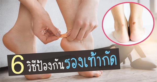 วิธีป้องกันรองเท้ากัด วิธีป้องกันรองเท้ากัด