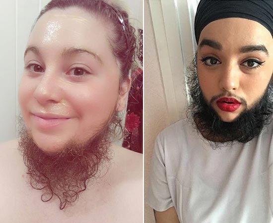 ผู้หญิงมีหนวด ผู้หญิงมีหนวด