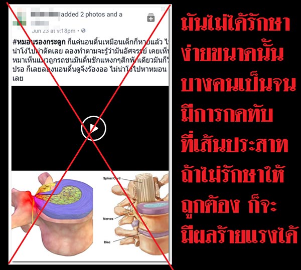 หมอนรองกระดูกทับเส้นประสาท หมอนรองกระดูกทับเส้นประสาท