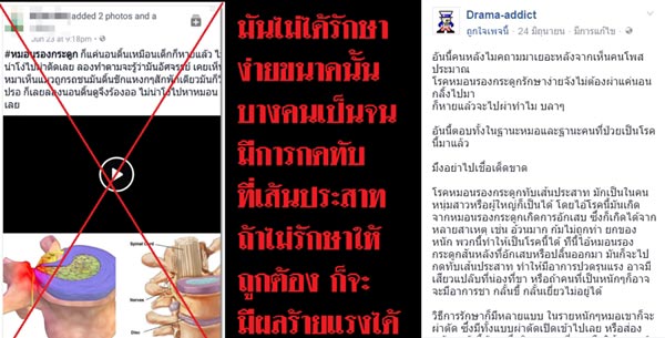 หมอนรองกระดูก หมอนรองกระดูก