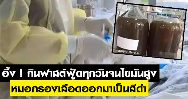 ไขมันในเลือดสูง ไขมันในเลือดสูง