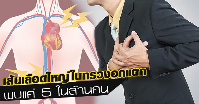 เส้นเลือดใหญ่ในทรวงอกแตก เส้นเลือดใหญ่ในทรวงอกแตก