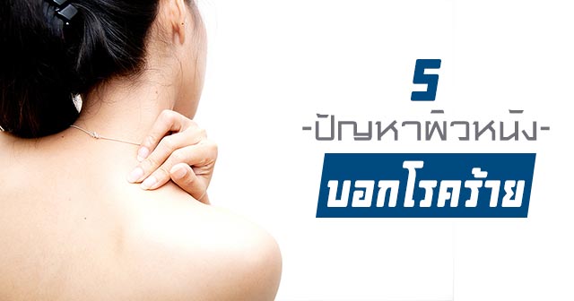 ผิวหนังบอกโรค ผิวหนังบอกโรค