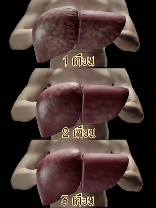 พักตับ พักตับ