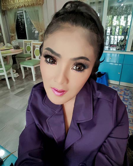 ดาว มยุรี ศัลยกรรม ดาว มยุรี ศัลยกรรม