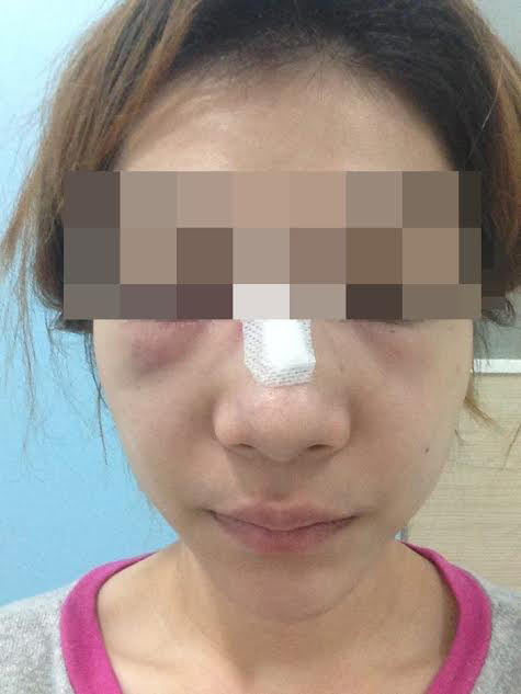 อาร์ท เทคมีเอ้าท์ อาร์ท เทคมีเอ้าท์