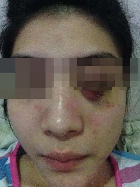 อาร์ท เทคมีเอ้าท์ อาร์ท เทคมีเอ้าท์