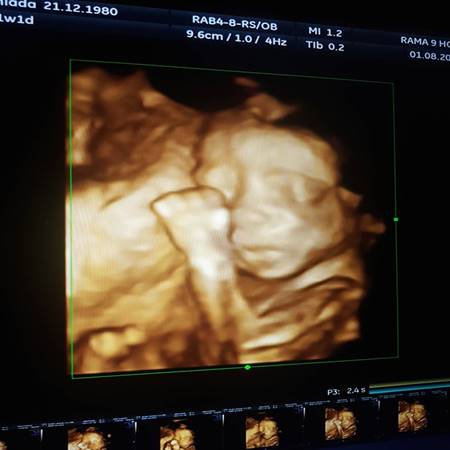 แอนดี้ เขมพิมุก แอนดี้ เขมพิมุก