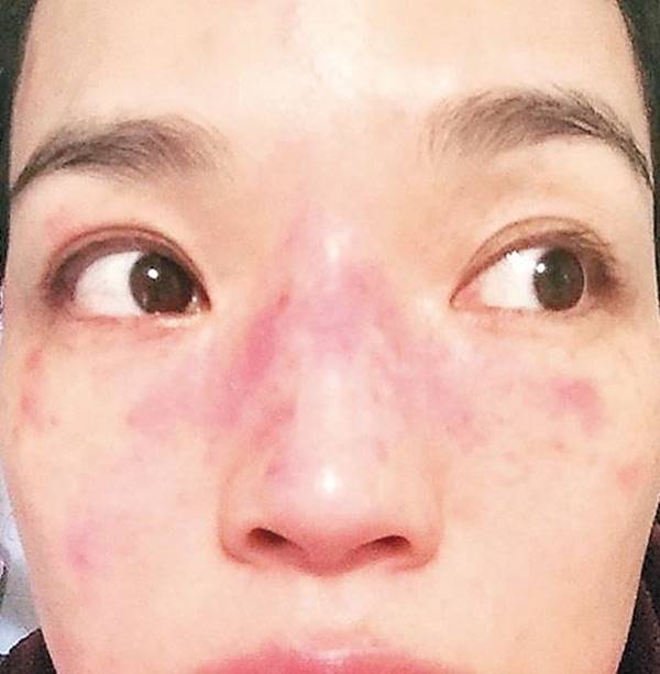 ซูฉี ซูฉี