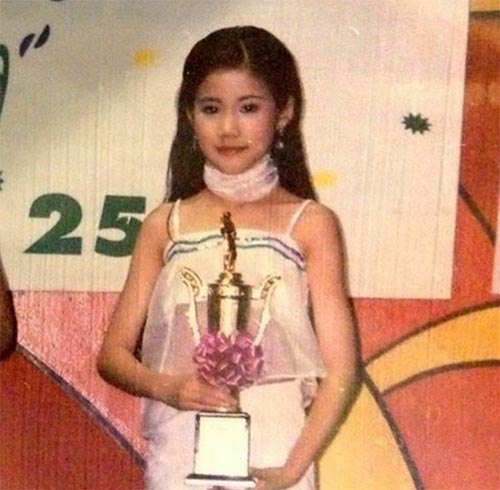 เอสเธอร์ สุปรีย์ลีลา ศัลยกรรม เอสเธอร์ สุปรีย์ลีลา ศัลยกรรม