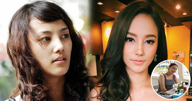 กุญแจซอล ศัลยกรรม กุญแจซอล ศัลยกรรม