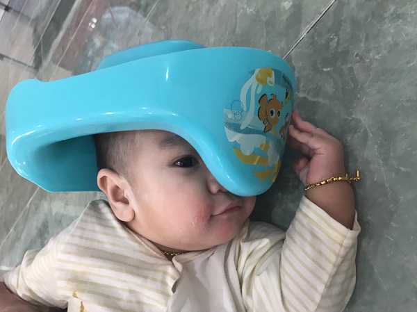 กุ้งลูกเขย กุ้งลูกเขย