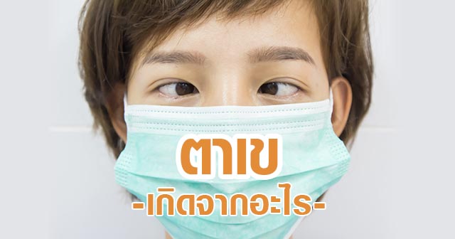 ตาเข ตาเหล่ ตาเข ตาเหล่