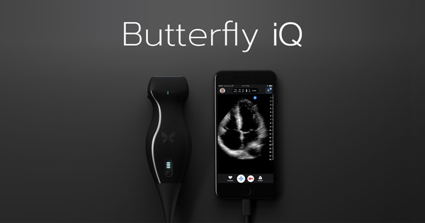 Butterfly iQ เครื่องอัลตราซาวด์ย่อส่วน Butterfly iQ เครื่องอัลตราซาวด์ย่อส่วน