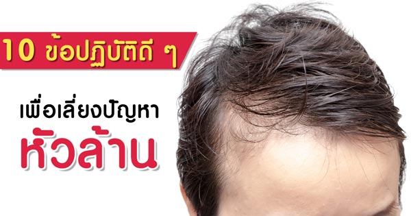 ปัญหาหัวล้าน ปัญหาหัวล้าน