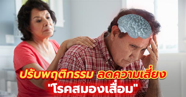 โรคสมองเสื่อม โรคสมองเสื่อม