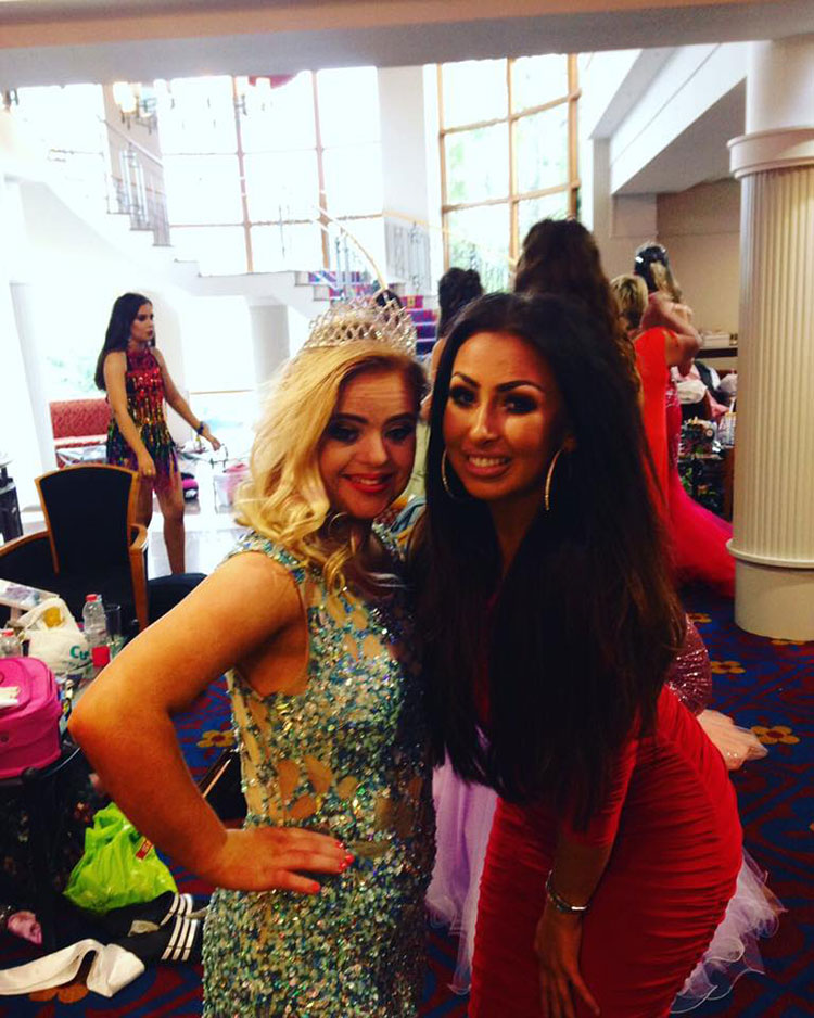 สาวดาวน์ซินโดรม คว้ามงกุฎนางงาม Teen Ultimate Beauty Of The World สาวดาวน์ซินโดรม คว้ามงกุฎนางงาม Teen Ultimate Beauty Of The World