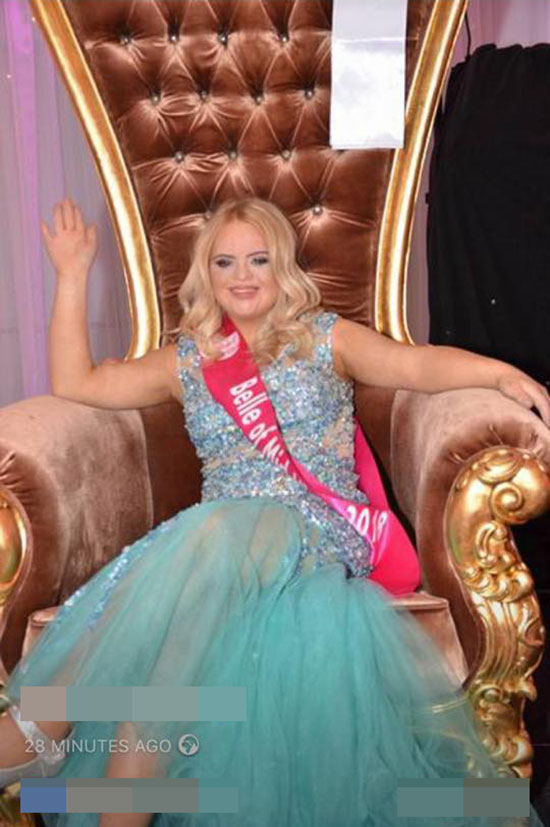 สาวดาวน์ซินโดรม คว้ามงกุฎนางงาม Teen Ultimate Beauty Of The World สาวดาวน์ซินโดรม คว้ามงกุฎนางงาม Teen Ultimate Beauty Of The World