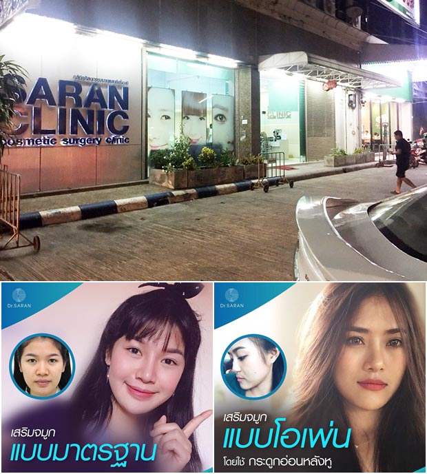 ทำจมูกที่ไหนดี ทำจมูกที่ไหนดี