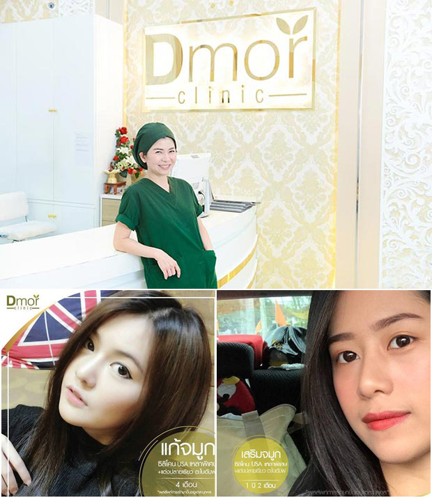 ทำจมูกที่ไหนดี ทำจมูกที่ไหนดี