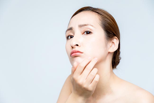 วิธีรักษาฝ้า วิธีรักษาฝ้า