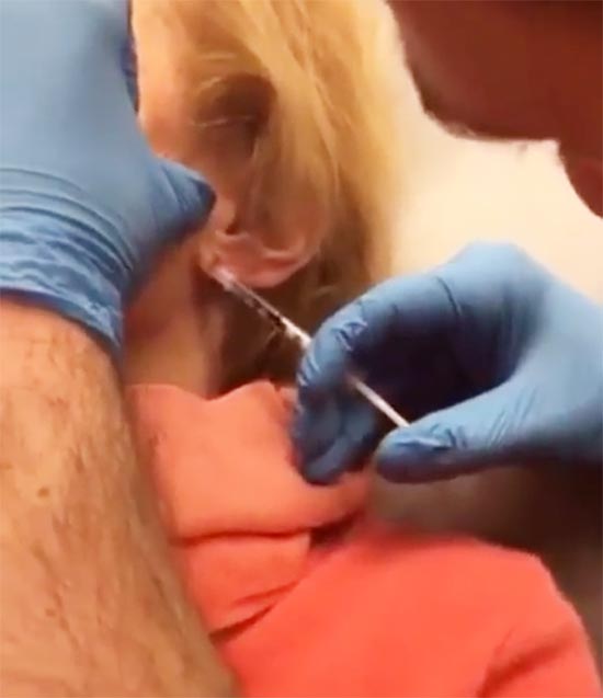 ฉีดฟิลเลอร์ ฉีดฟิลเลอร์