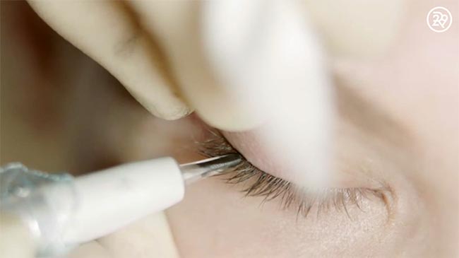 สักขอบตา สักขอบตา