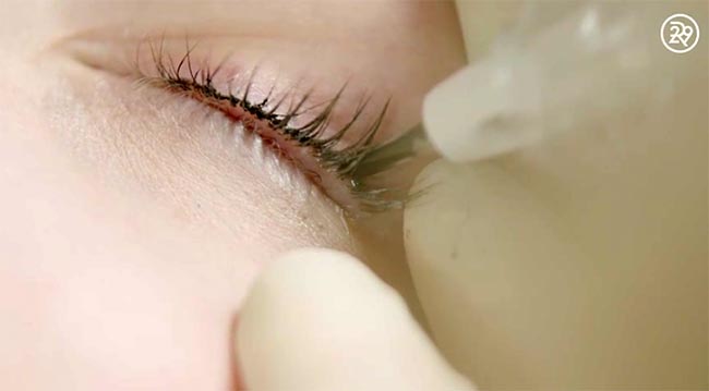 สักขอบตา สักขอบตา