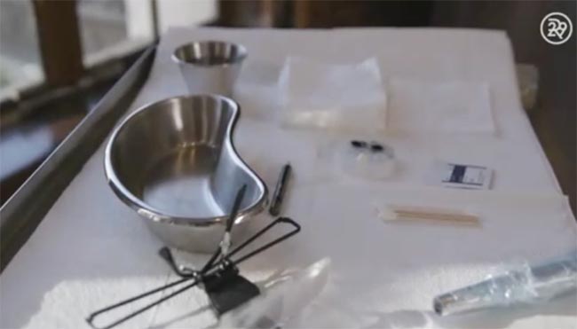 สักขอบตา สักขอบตา