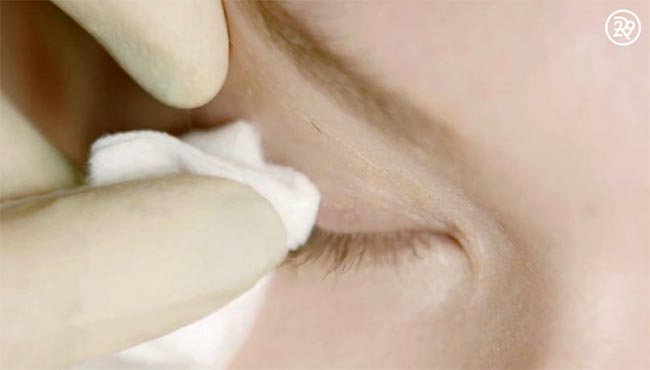 สักขอบตา สักขอบตา