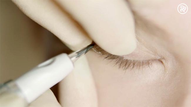 สักขอบตา สักขอบตา