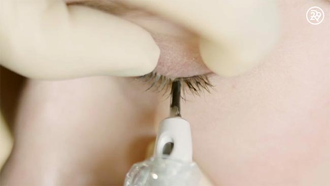 สักขอบตา สักขอบตา