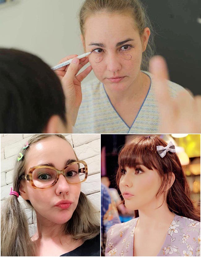 ดาราศัลยกรรมเกาหลี ดาราศัลยกรรมเกาหลี