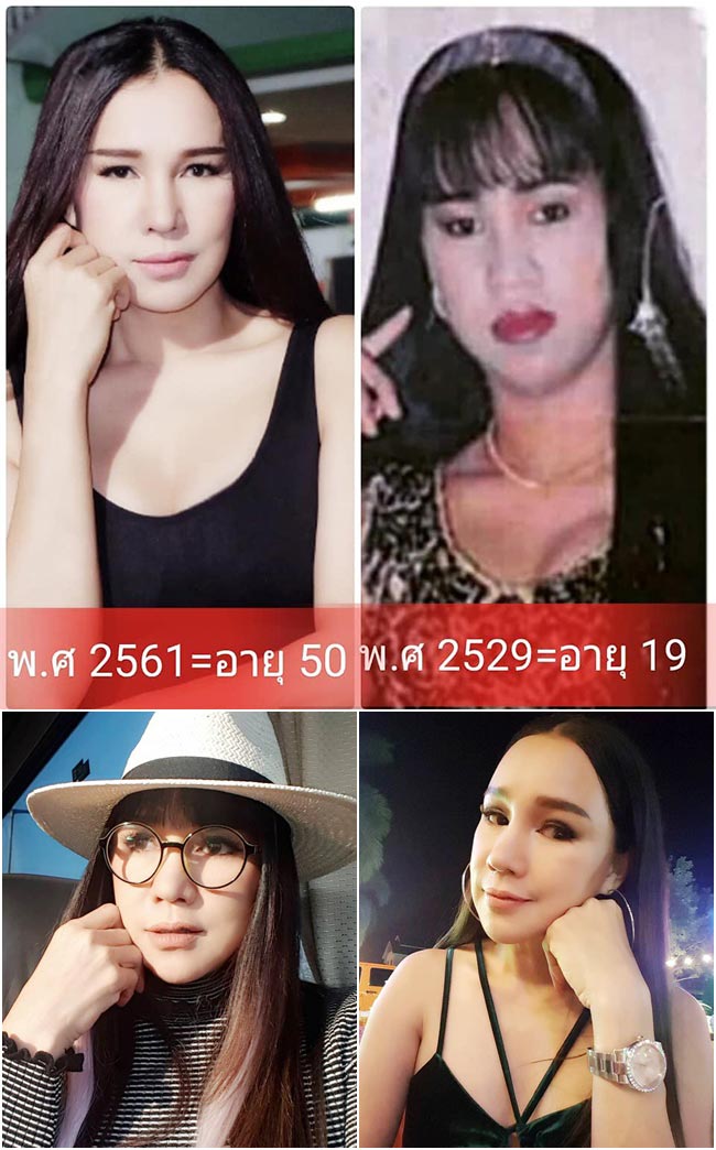 ดาราศัลยกรรมเกาหลี ดาราศัลยกรรมเกาหลี