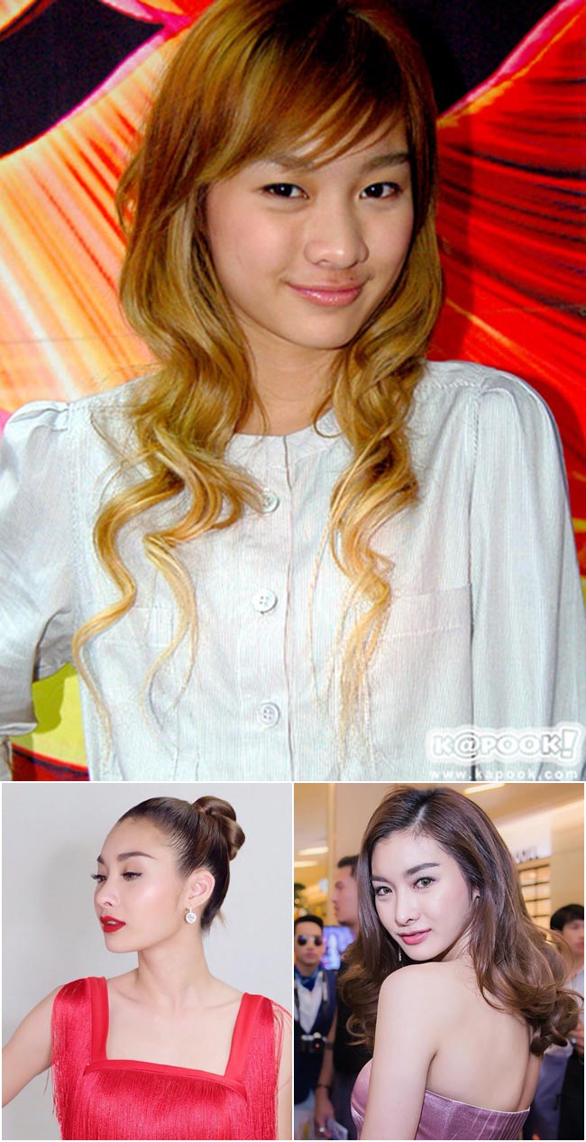 ดาราศัลยกรรมเกาหลี ดาราศัลยกรรมเกาหลี