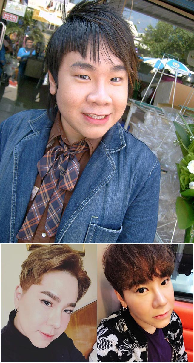 ดาราศัลยกรรมเกาหลี ดาราศัลยกรรมเกาหลี