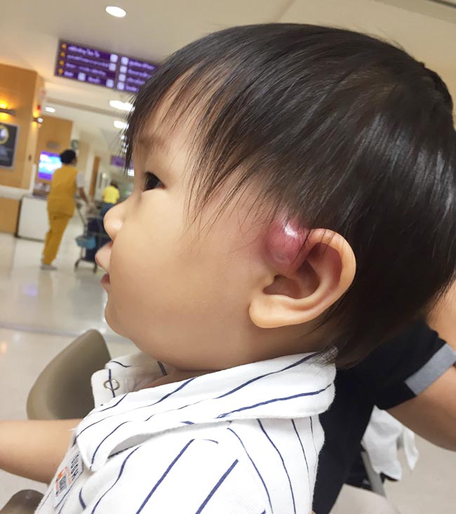 รูเล็กๆข้างหู รูเล็กๆข้างหู