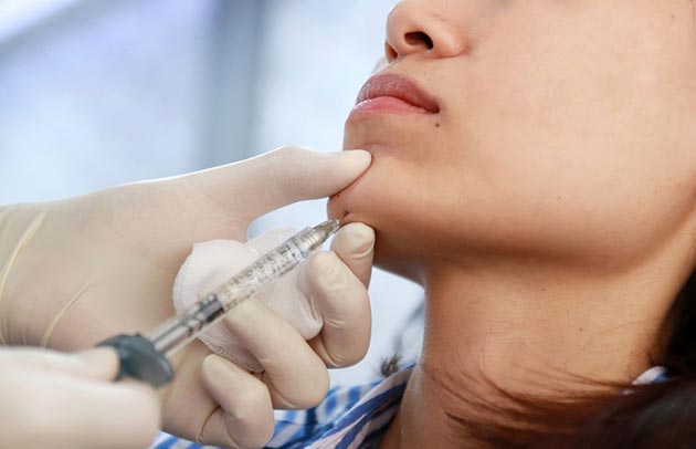 เสริมคาง เสริมคาง