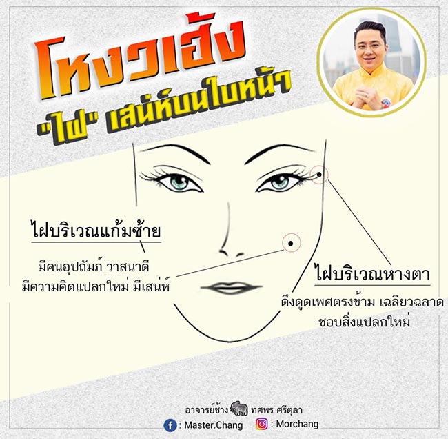 หมอช้าง หมอช้าง