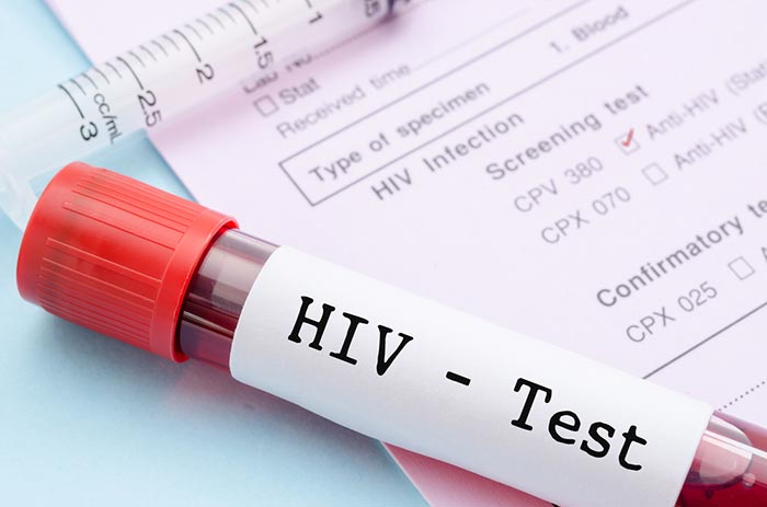 ยาต้านไวรัส HIV ยาต้านไวรัส HIV