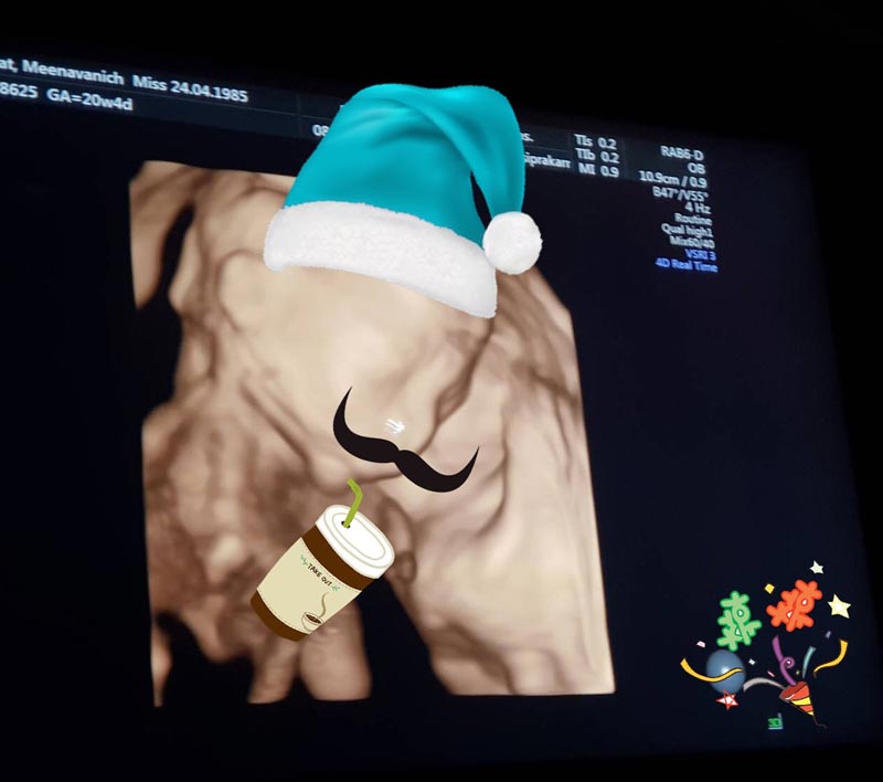 เบนซ์ พริกไทย เบนซ์ พริกไทย