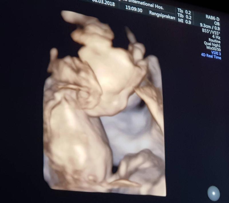 เบนซ์ พริกไทย เบนซ์ พริกไทย