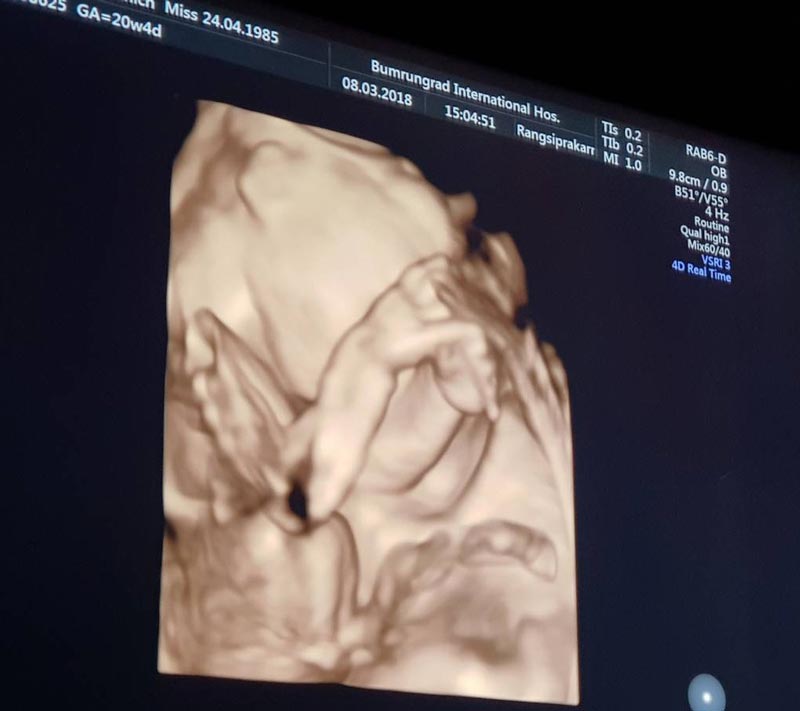 เบนซ์ พริกไทย เบนซ์ พริกไทย